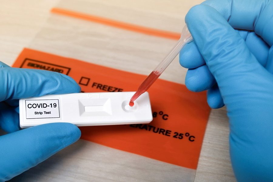 Covid-19: African Union releases new guidance on use of Rapid Antigen Tests