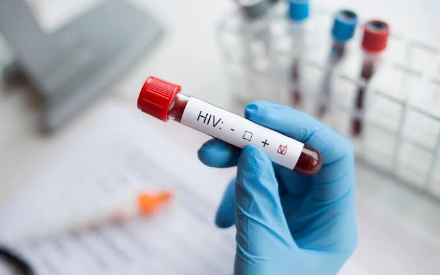 UNAIDS solicits $29 billion fund for Nigeria, other low-income countries to end HIV epidemic  