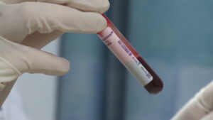 Researchers identify blood test that could detect ovarian cancer early 